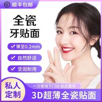 Ivoca all-ceramic veneer ultra-thin porcelain whitening patch imported blue porcelain amber Lingxi porcelain private customization