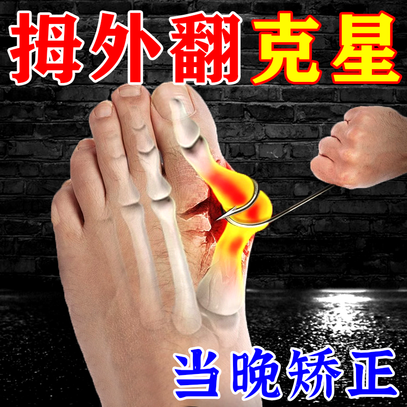 (Large Footed Bone No early with early laughs) Thumb Valgus paste with hallux valgus musculature with large foot bone toe straightener-Taobao