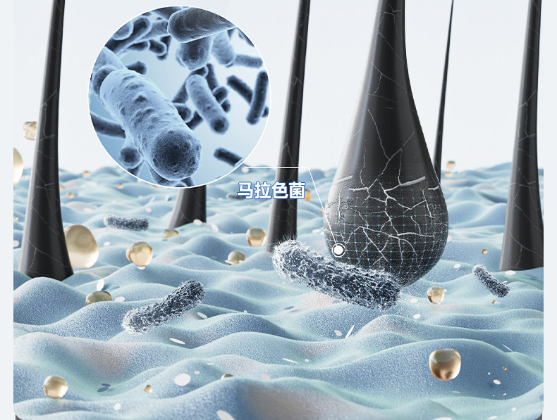 999 二硫化硒洗劑 脂漏性皮膚炎 去頭皮屑 毛囊炎洗髮精 止癢 花斑 汗癬 150g*1瓶/盒