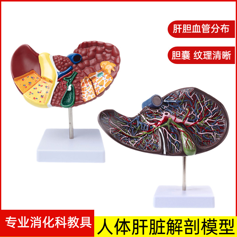 高度仿真肝脏模型肝解剖模型肝胆胰脾十二指肠浮雕病变肝胆胰模型
