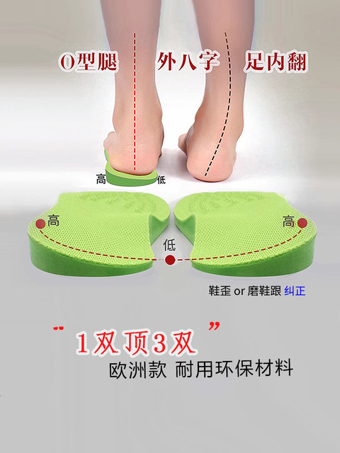 Insoles for Correcting Splayed Feet, O-Shaped Legs, High Outside and Low Inside, Calf Valgus, Foot Valgus Correction Device for Children and Adults