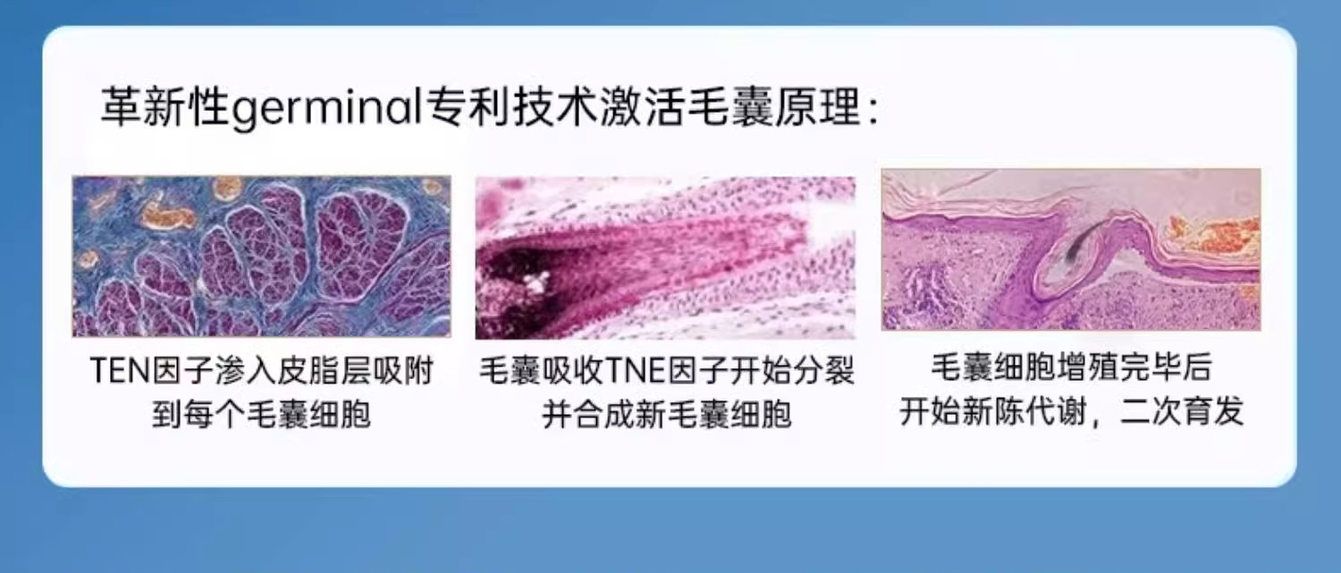 【香港直邮】 OHBT 防脱育发精华 100ml 男女通用 油头救星 打造健康头皮