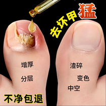 (Watsons best-selling) One drop of it can inhibit bacteria without removing nails and remove 99% of gray potassium fungi. If invalid return guarantee