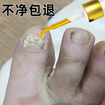 No guarantee no repair just one drop in the morning and evening the effect is so good bad nails turn into good ones fingers and toes are repaired and turned into good ones.