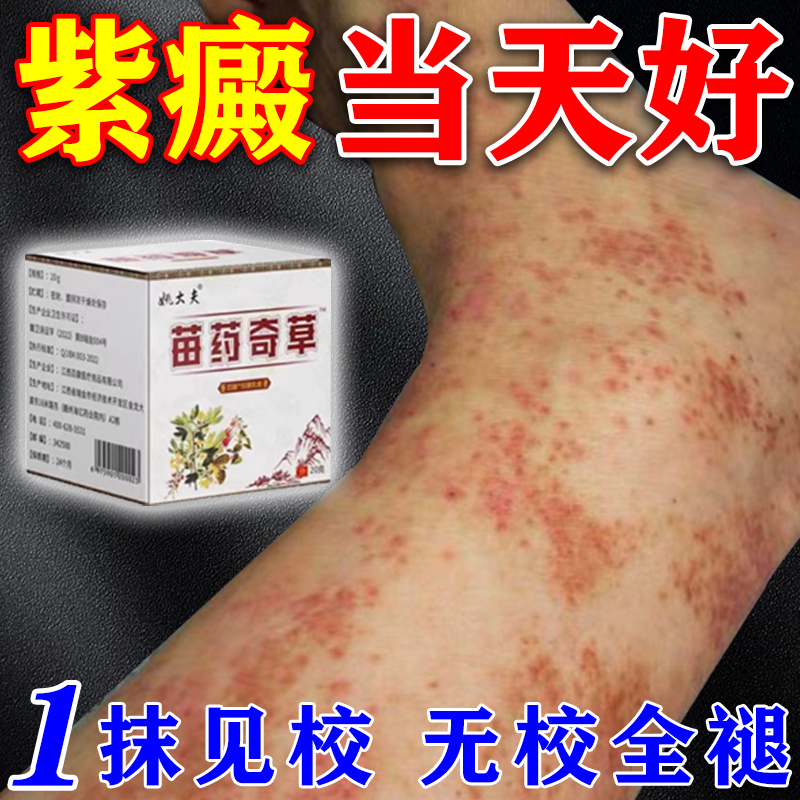 紫斑病特効薬 アレルギー性皮膚炎 血管炎 老人性色素斑 紫斑 皮下出血 赤斑 軟膏