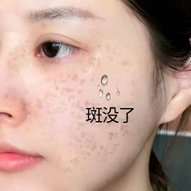 (Recommended by Watsons) Remove dark spots spots and blemishes on your face and leave your face clean. Say goodbye to spots~