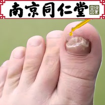 Unrepaired. Sooner or later fingertoe repair to better potassium. Its good bad armor to better