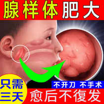 儿童腺样体肥大面容矫正器睡觉张嘴呼吸打呼噜鼻塞过敏调理中药贴