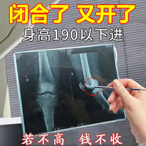 2023 hot model Xiaohongshu recommends ways to grow taller to help you get rid of worries. Valid for 12 to 48 years old. Unisex.