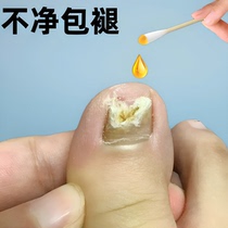 (Tongrentang hot sale) Painless replacement of potassium enjoy a good nail life turn bad nails into good ones drop by drop