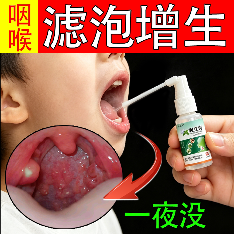Follicular Hyperplasia, Lumps on the Back of the Throat, Foreign Body Sensation, Itching, Dry Tonsils, Sore Throat, Phlegm Repair, Herbal Spray Follicular Hyperplasia, Lumps on the Back of the Throat, Foreign Body Sensation, Itching, Dry Tonsils, Sore Throat, Phlegm Repair, Herbal Spray