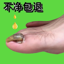 Drop a drop of antibacterial without removing 99 % gray potassium fungus invalid