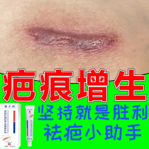 Scar hyperplasia bumps to remove the lump thoracic anterior pregnancy veins to scar the caesarean section and burn scalds surgical scarring repair