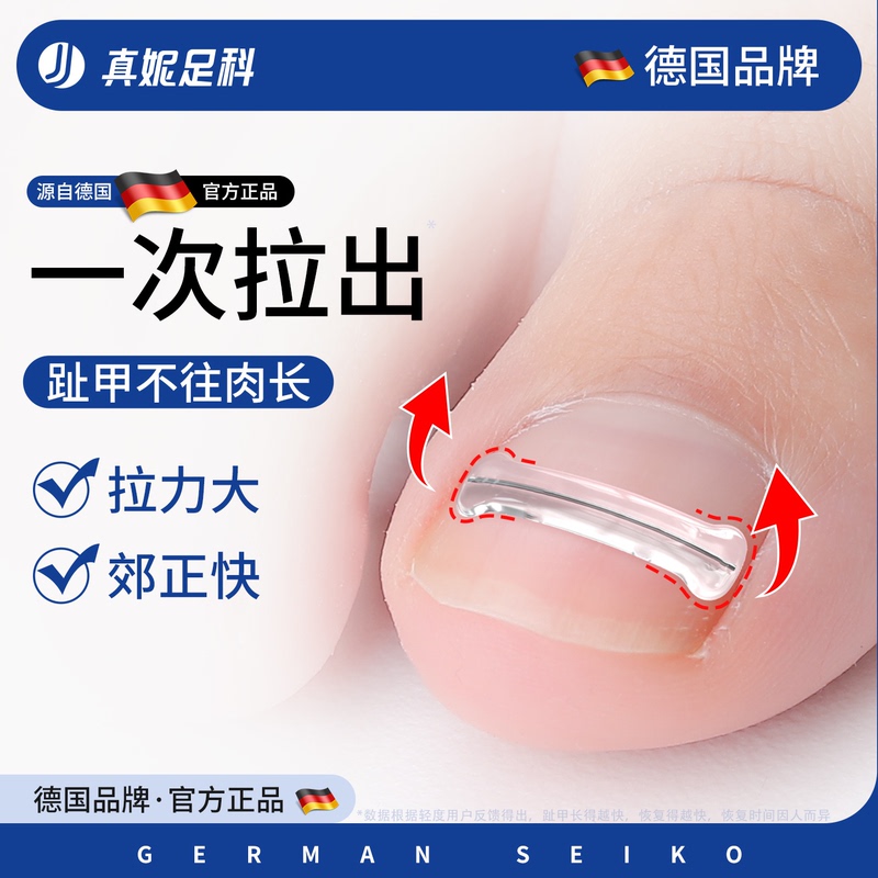 Nail Groove Corrector for Ingrown Nails, Specialized for Correcting Inflammation and Correcting Nails That Grow into the Flesh, Nail Patch Tool
