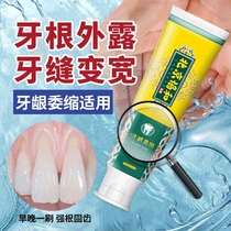 Repair artifact for wide tooth gaps exposed tooth roots large gum recession repair toothpaste oral treatment for periodontitis