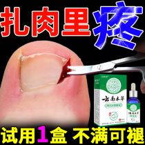 Special soft nails for paronychia detumescence granulation reduction and antibacterial liquid for paronychia treatment. Special medicine for paronychia treatment to remove polyps and soft nails.