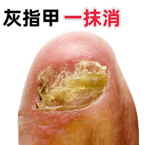(Tongrentang hot sale) Painless replacement of potassium enjoy a good nail life turn bad nails into good ones drop by drop