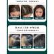 [Authentic North China Pharmaceutical Product]Two Capsules a Day - No Need to Worry about Thinning Hair - Suitable for Both Men and Women of All Ages