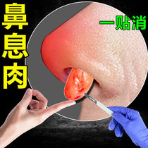 (Recommended by tens of millions of people) A special patch for nasal polyp removal. Sinusitis turbinate hypertrophy nasal congestion and blocked air circulation.