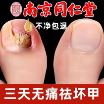 Tongcheng sells 100000 ; no pain - free drop to remove bad potassium gray potassium star