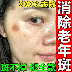 Special ointment for removing age spots, a powerful traditional Chinese medicine ointment for removing dark spots and chloasma in the elderly, removing dark spots on hands and face