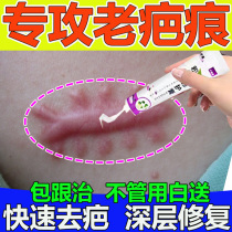 Remove hypertrophic scars keloids bulges remove wounds caesarean section burns and scalds surgical scars old scars soften scars repair cream