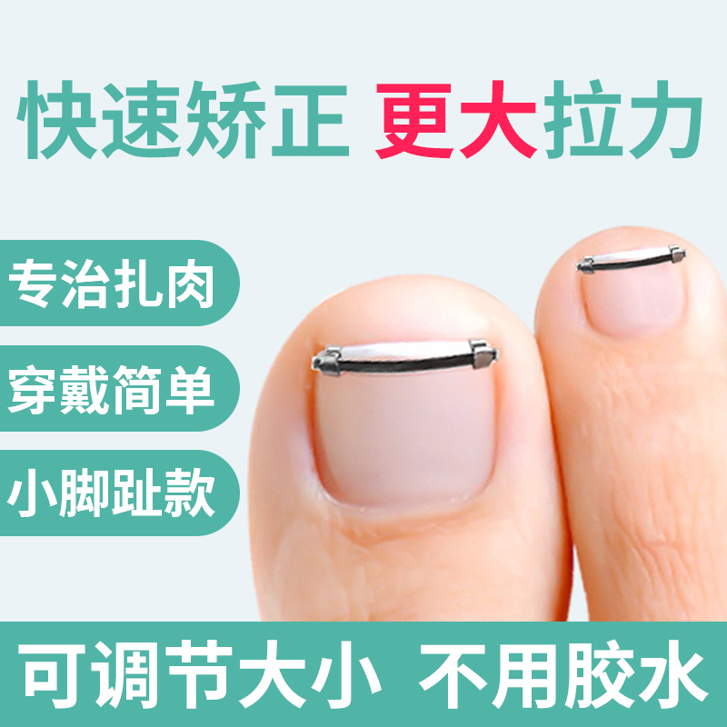 Ingrown Toenail Corrector, Ingrown Toenail Correction Device, Toe Nail Correction Tool, Special Nail Correction Clip, Nail Correction Patch Ingrown Toenail Corrector, Ingrown Toenail Correction Device, Toe Nail Correction Tool, Special Nail Correction Clip, Nail Correction Patch