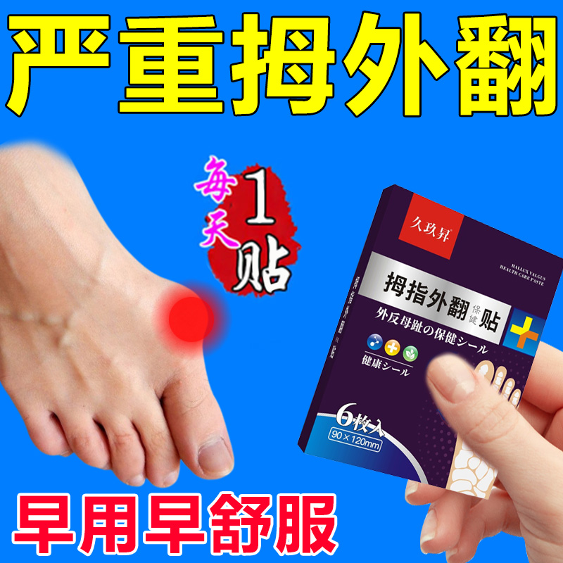 (100 thousand people have been corrected) Thumb Valgus straightener for large female toe Valgus Toe Straightener Special Sticker-Taobao