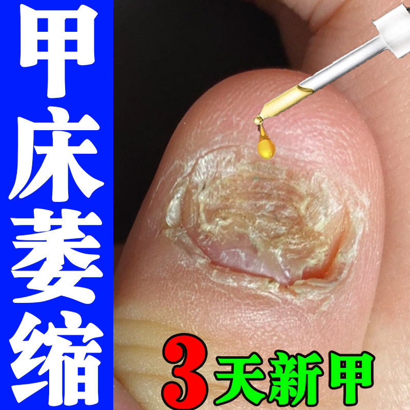 Nail Regrowth and Repair Solution for Brittle Nails, Nail Biting, Damaged Nails, Short Nails, Separated Nail Cuticles, Uneven Nails, Broken Nails, Vertical Lines