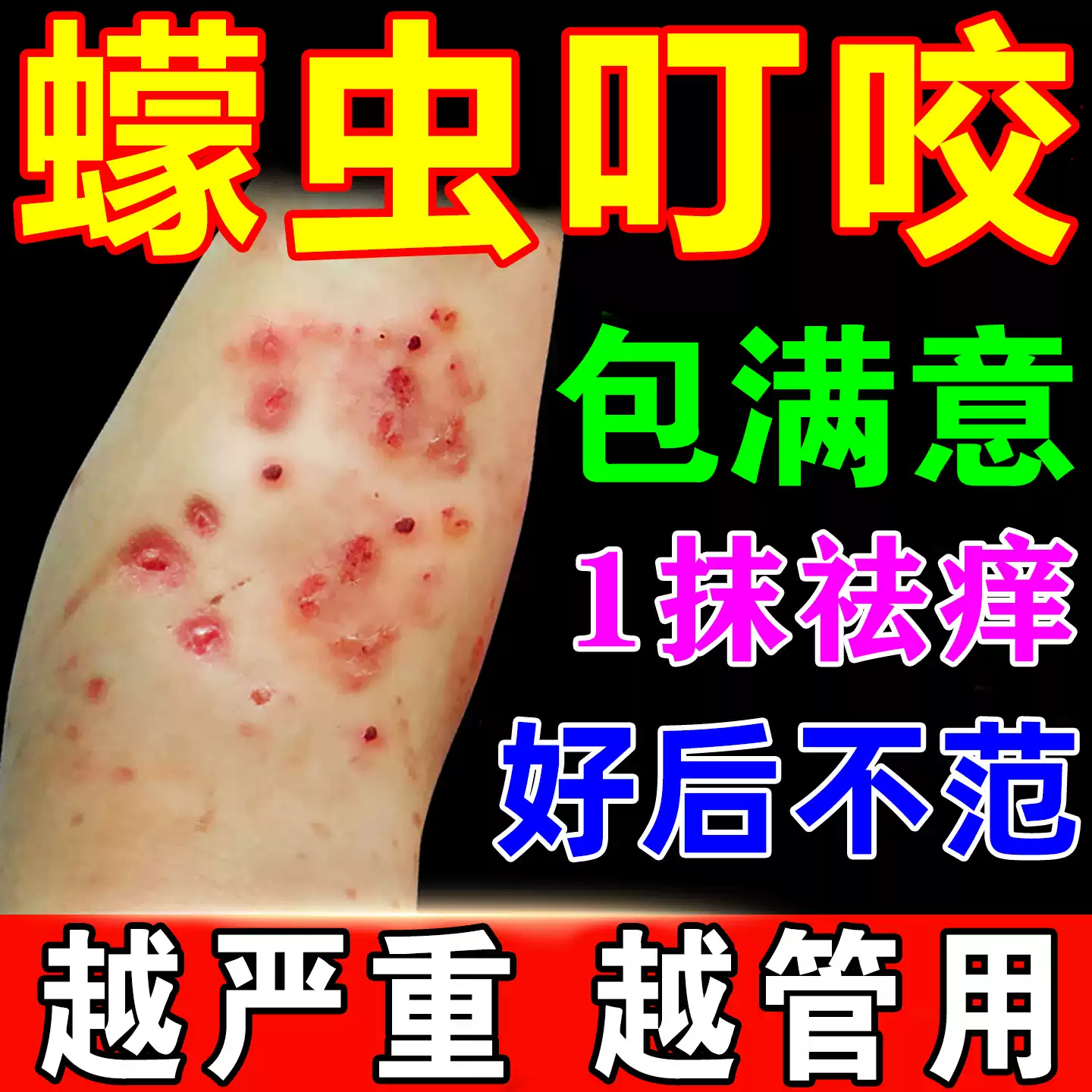 蠓虫咬伤止痒膏蚊虫叮咬快速止痒红肿消药膏防, image size:1440x1440