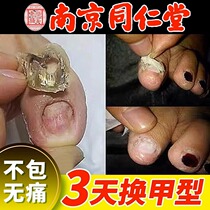 Tong Ren Tang Hot Sale (Grow New Nails in Seven Days) One drop of it can turn bad nails into good ones and grow new nails without removing the nails.
