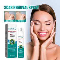 Scar Remover Spray Repair Stch Mark Firming Body Treatment S