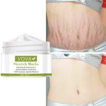 Stch Mark Remove Cream Postpartum Obesity Maternity Skin Re