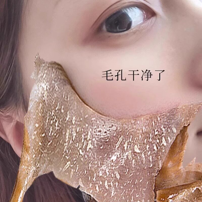 (Kuchen's Exploits) Clean pores to clog deep cleaning dirt to collect pores to go to facial pores garbage-Taobao