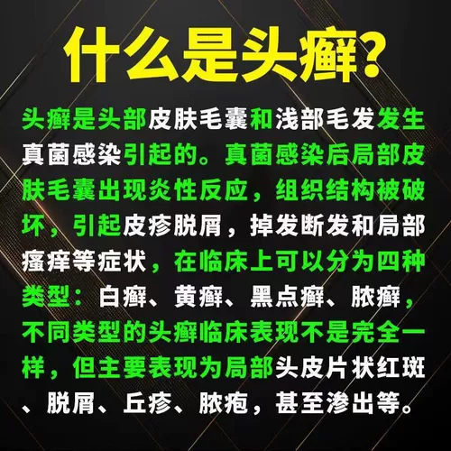 Процентное хлоропрозлочное кремовое лечение кожи экзема псориаз псориаз, не связанный с рецептом, пептический оксил -оксил -пропионат пептат мочевина