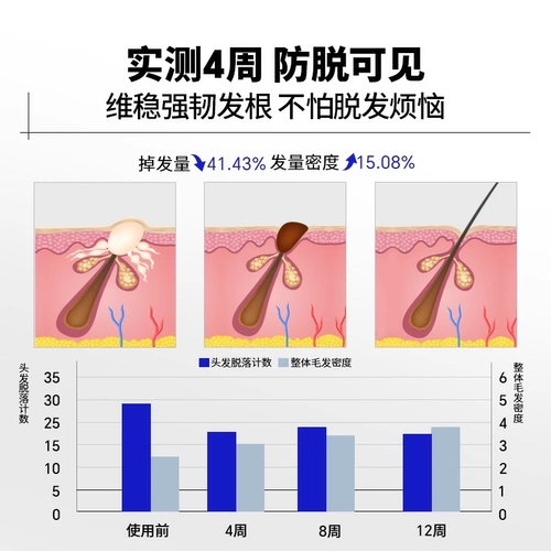 EHD Водостойкий шампунь, кондиционер с имбирем по линии роста волос, против выпадения волос, придает объем