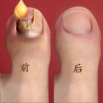 (Tongrentang Hot Sell) No pain for new potassium to enjoy a good A life Bad A to get a good jia drop a drop
