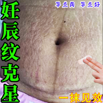 Stretch Marks Elimination Stretch Marks Firming Belly Stretch Marks Special Repair Cream Obesity Marks Growth Marks Fading Cream