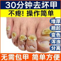 Qianmingcao Chuni Enzymatic Gel Bad Nail Onychomycosis Cleaner Soft Nail Cream Manicure Liquid Onychomycosis Repair Kit Buy 2 Get 1 Free