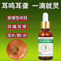 Erkang Coptis chinensis liquid ear drops Erkang Coptis chinensis liquid ear drops Erkang Coptis chinensis liquid ear drops
