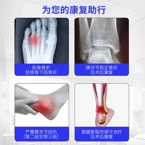 Ober Соединение лодыжки корзин