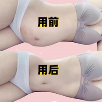 Recommended by Xiaohongshu. Use before going to bed to wake up and lose weight. Lazy people tighten their abdomen. Fat people always have it. Unisex. Lose weight.