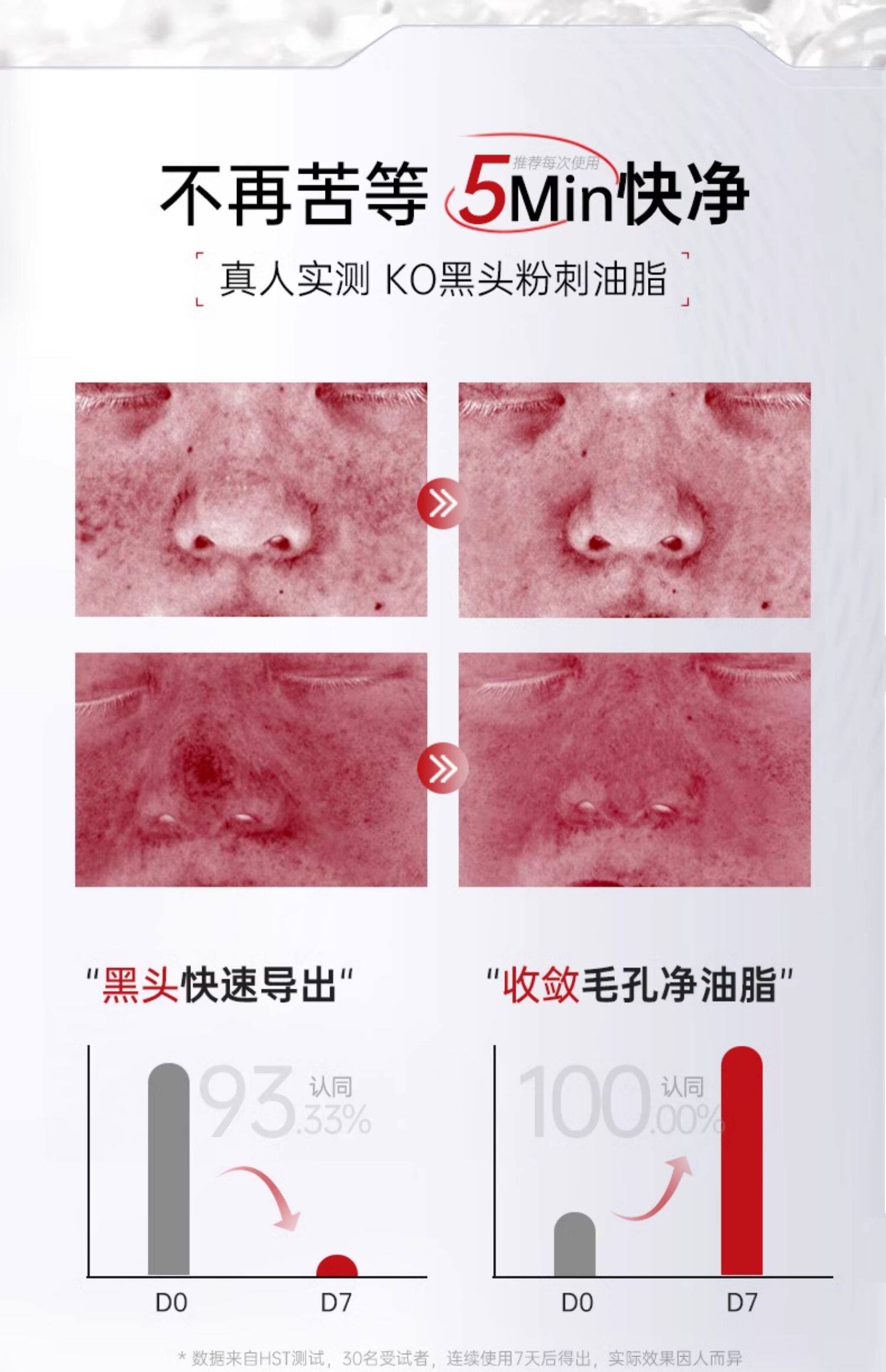广药白云山 壬二酸净肤清洁泥膜棒  壬二酸+水杨酸双效   导出毛孔   细嫩净孔   李若彤同款   40g/瓶