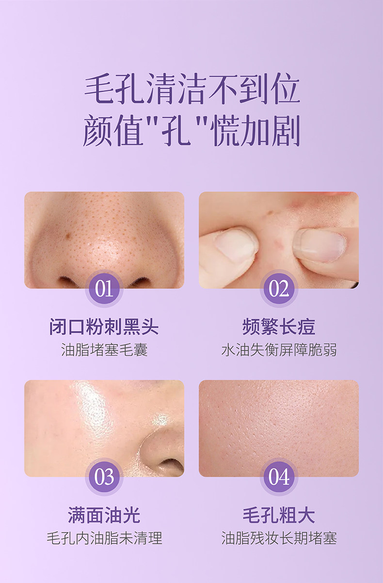 eLL 紫苏壬二酸清洁泥膜控油收缩毛孔去黑白头闭口粉刺涂抹式面膜100g