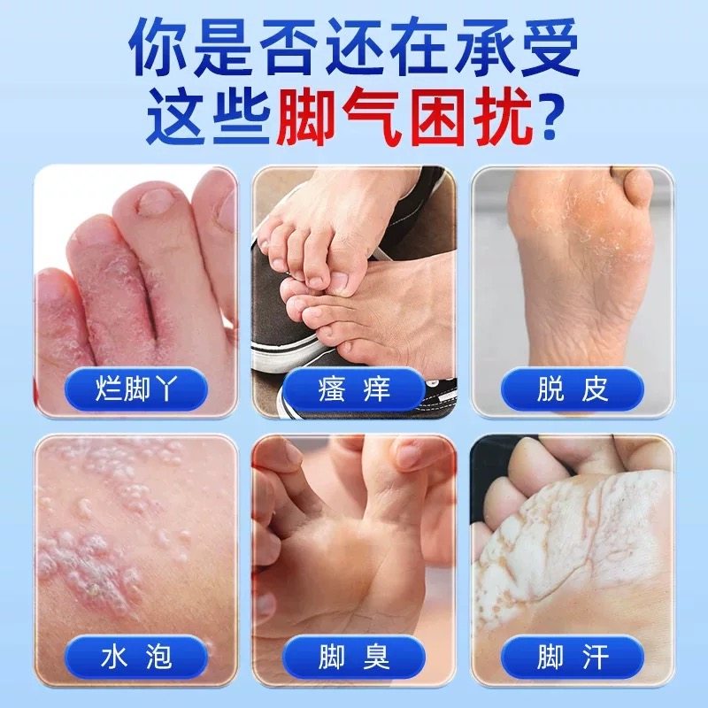 脚气药根治止痒真菌感染,告别烂脚丫痒脱皮,儿童专用膏来帮忙!👣 -会计-淘宝百科网