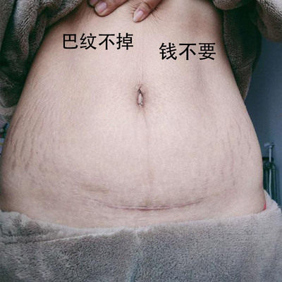 (Küchen's recommendation to remove the body 99% marks) body leaving no trace of embarrassment is no longer awkward-Taobao