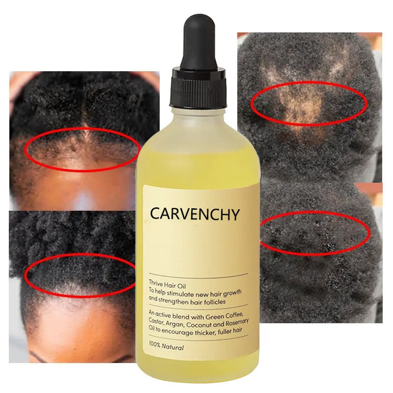 Thrive Hair Growth Oil Perm Dye Damaged Hair Oil Hair CareTaobao