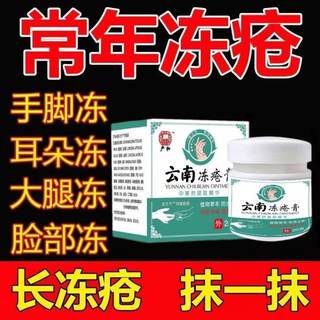 Крем от охлаждения и покраснений Yunnan Herbal, противозудная мазь от охлаждения, специальный эффект, против трещин, зимний крем от охлаждения для детей и взрослых, для рук, ног, ушей