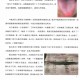 Yang Chunhu's Clinical Practical Records of Traditional Chinese Medicine [Color Print] - Basic Knowledge for Identifying Diseases and Tongue Diagnosis in Shanghan Syndrome