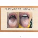 Yang Chunhu’s Tongue Diagnosis Formulas and Basic Knowledge of Tongue Diagnosis and Disease Recognition: Start with Dialectics of Tongue Quality for Typhoid Fever, Color Print